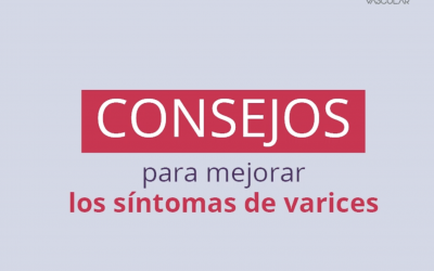 Consejos para mejorar los síntomas de varices