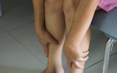Piernas cansadas, una posible advertencia de la salud vascular