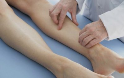 Especialistas alertan del infradiagnóstico del síndrome de May-Thurner, una causa frecuente de trombosis en mujeres jóvenes
