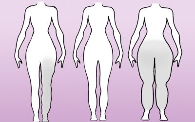 Lipedema y linfedema, dos enfermedades con síntomas parecidos, pero tratamientos distintos